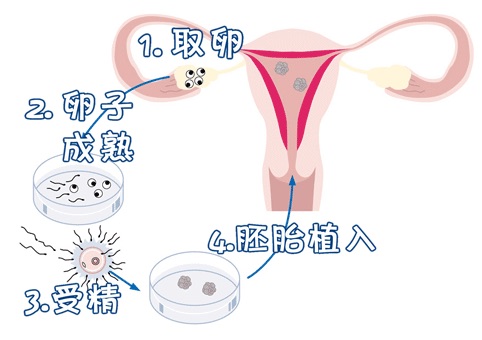 关于明远生殖医学中心